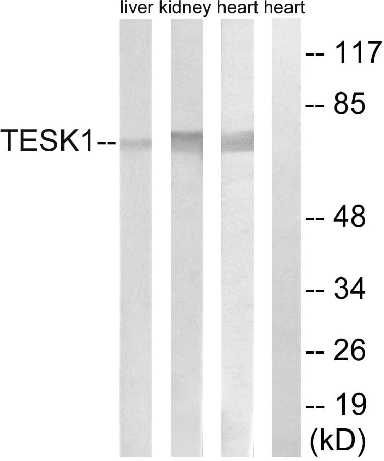 Western blot analysis of lysates from rat heart, rat kidney, and rat liver cells using Anti-TESK1 Antibody. The right hand lane represents a negative control, where the antibody is blocked by the immunising peptide.