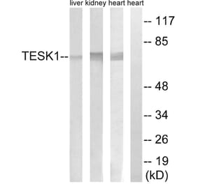 Western Blot - Anti-TESK1 Antibody (C15503) - Antibodies.com
