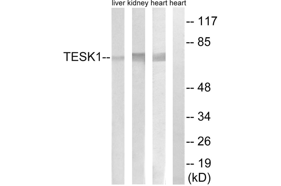 Western Blot - Anti-TESK1 Antibody (C15503) - Antibodies.com