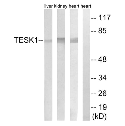 Western Blot - Anti-TESK1 Antibody (C15503) - Antibodies.com
