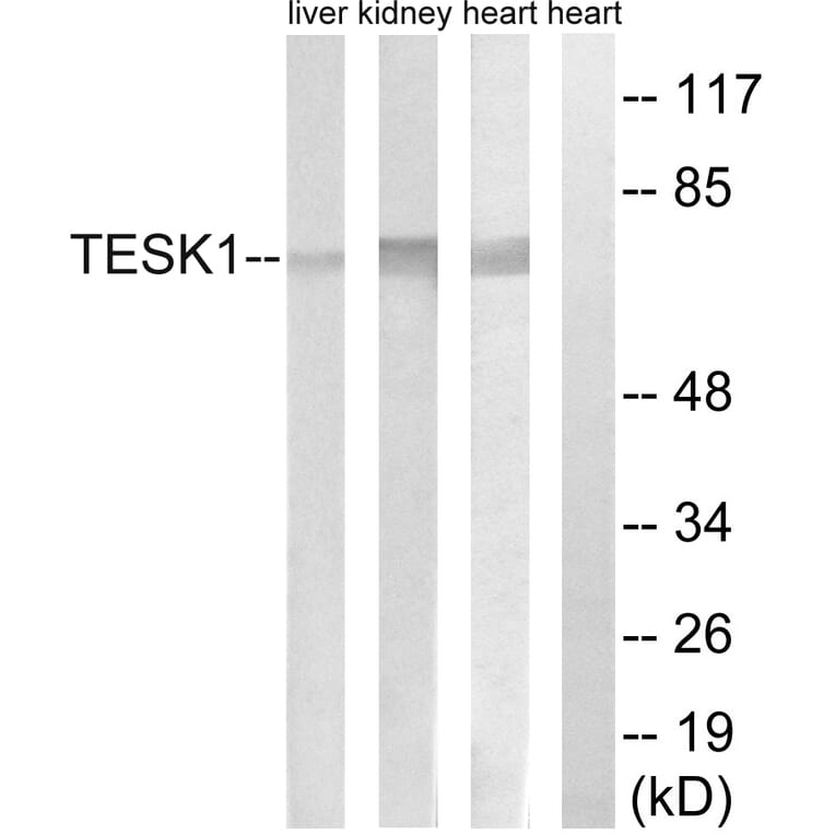 Western Blot - Anti-TESK1 Antibody (C15503) - Antibodies.com