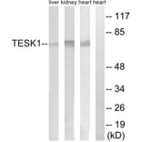Western Blot - Anti-TESK1 Antibody (C15503) - Antibodies.com