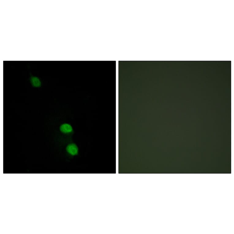 Immunofluorescence - Anti-TEAD2 Antibody (C11087) - Antibodies.com