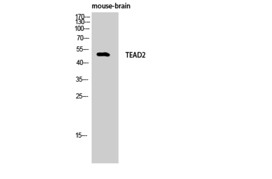 Western Blot - Anti-TEAD2 Antibody (C11087) - Antibodies.com