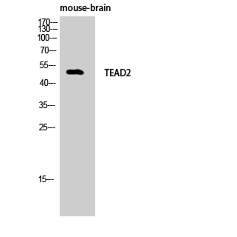 Western Blot - Anti-TEAD2 Antibody (C11087) - Antibodies.com