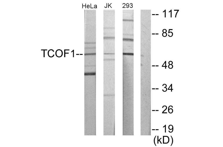 Western Blot - Anti-TCOF1 Antibody (C10977) - Antibodies.com