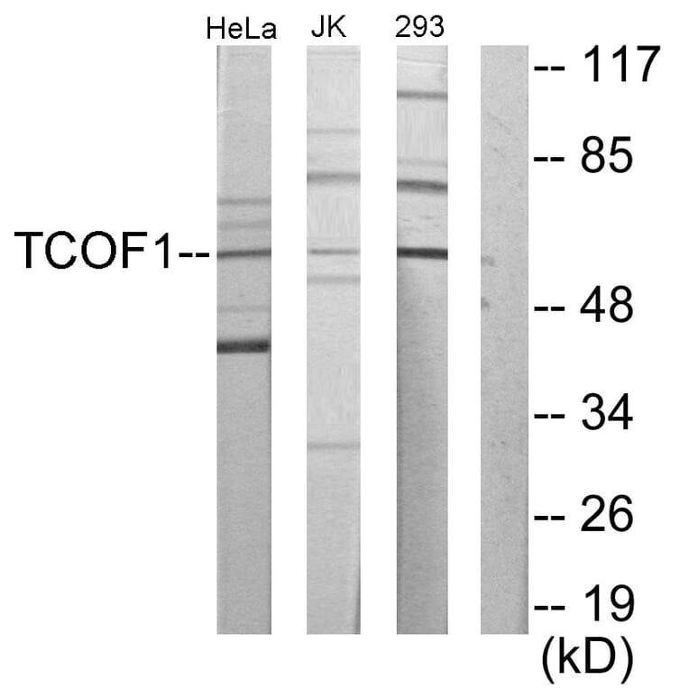 Western Blot - Anti-TCOF1 Antibody (C10977) - Antibodies.com