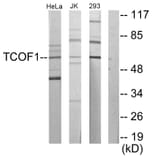 Western Blot - Anti-TCOF1 Antibody (C10977) - Antibodies.com