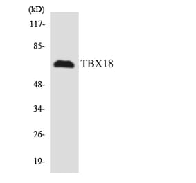 Western Blot - Anti-TBX18 Antibody (R12-3605) - Antibodies.com