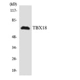 Western Blot - Anti-TBX18 Antibody (R12-3605) - Antibodies.com