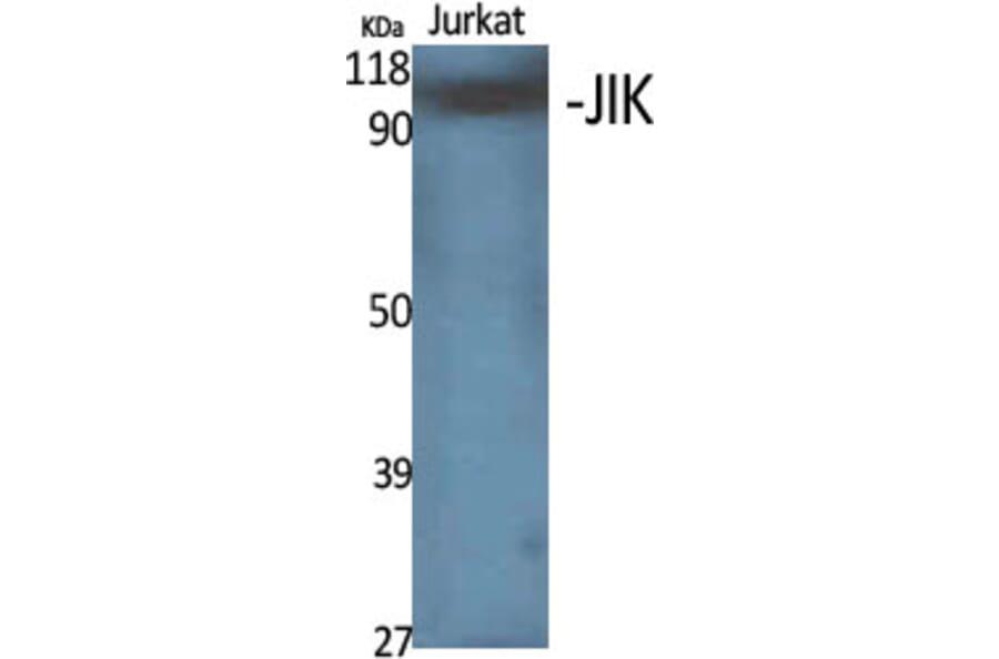 Western Blot - Anti-TAOK3 Antibody (C20696) - Antibodies.com