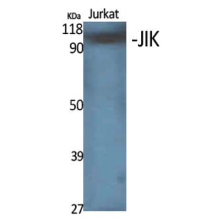 Western Blot - Anti-TAOK3 Antibody (C20696) - Antibodies.com