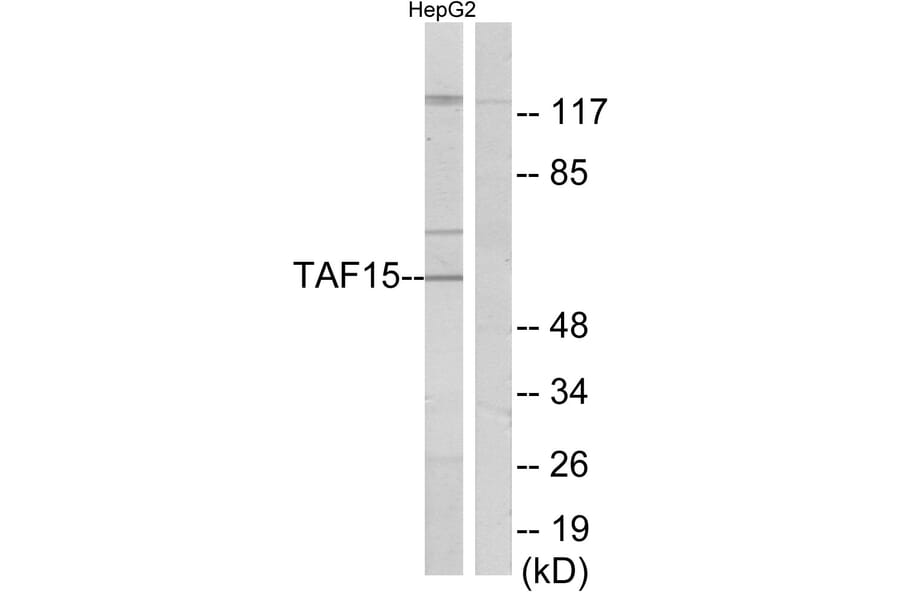 Western Blot - Anti-TAF15 Antibody (C11436) - Antibodies.com