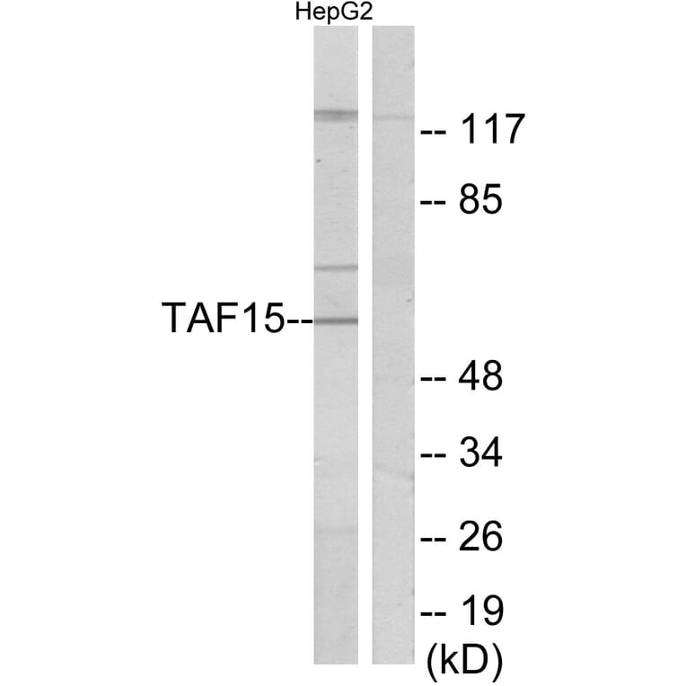 Western Blot - Anti-TAF15 Antibody (C11436) - Antibodies.com