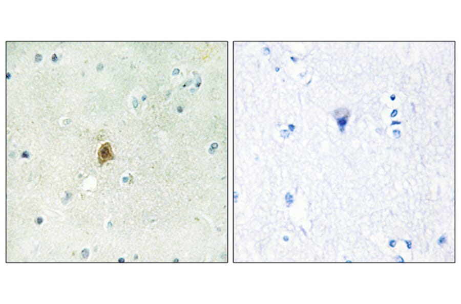 Immunohistochemistry - Anti-TAF15 Antibody (C11436) - Antibodies.com