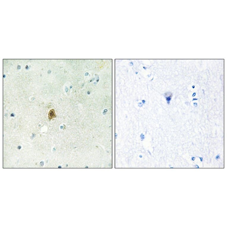 Immunohistochemistry - Anti-TAF15 Antibody (C11436) - Antibodies.com