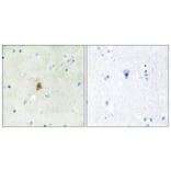 Immunohistochemistry - Anti-TAF15 Antibody (C11436) - Antibodies.com