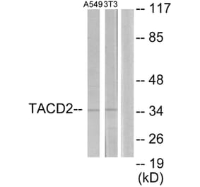 Western Blot - Anti-TACD2 Antibody (C10320) - Antibodies.com