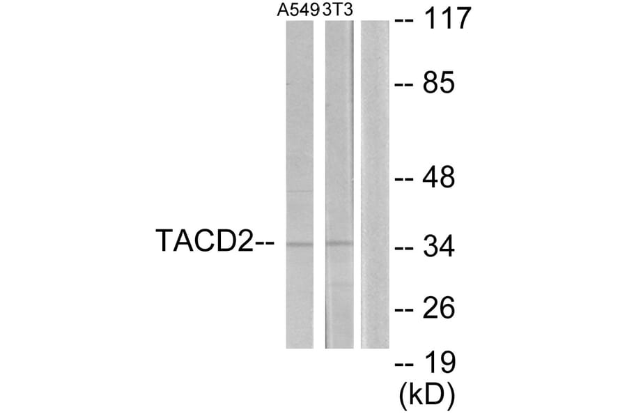 Western Blot - Anti-TACD2 Antibody (C10320) - Antibodies.com