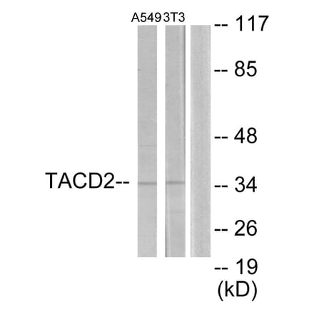 Western Blot - Anti-TACD2 Antibody (C10320) - Antibodies.com