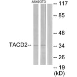 Western Blot - Anti-TACD2 Antibody (C10320) - Antibodies.com