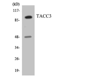 Western Blot - Anti-TACC3 Antibody (R12-3582) - Antibodies.com