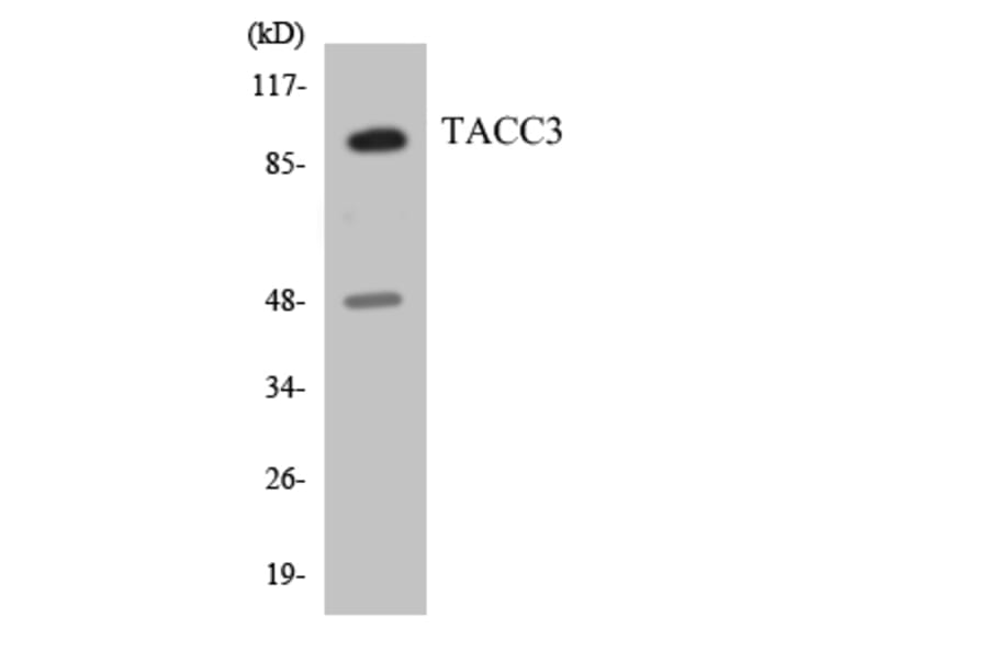 Western Blot - Anti-TACC3 Antibody (R12-3582) - Antibodies.com