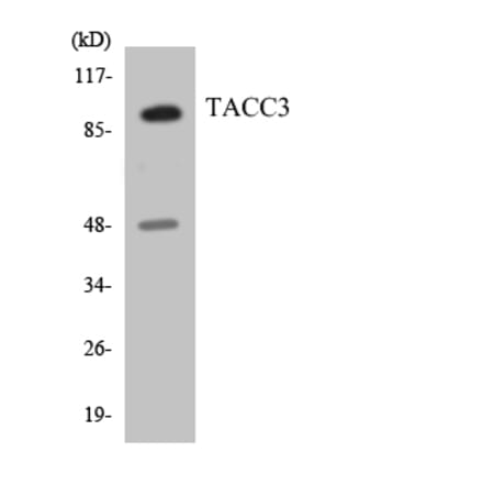 Western Blot - Anti-TACC3 Antibody (R12-3582) - Antibodies.com
