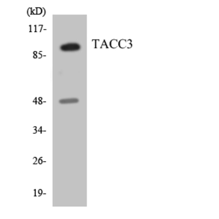 Western Blot - Anti-TACC3 Antibody (R12-3582) - Antibodies.com