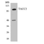 Western Blot - Anti-TACC3 Antibody (R12-3582) - Antibodies.com