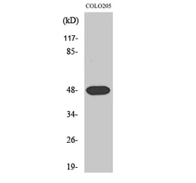 Western Blot - Anti-SYT11 Antibody (C19011) - Antibodies.com