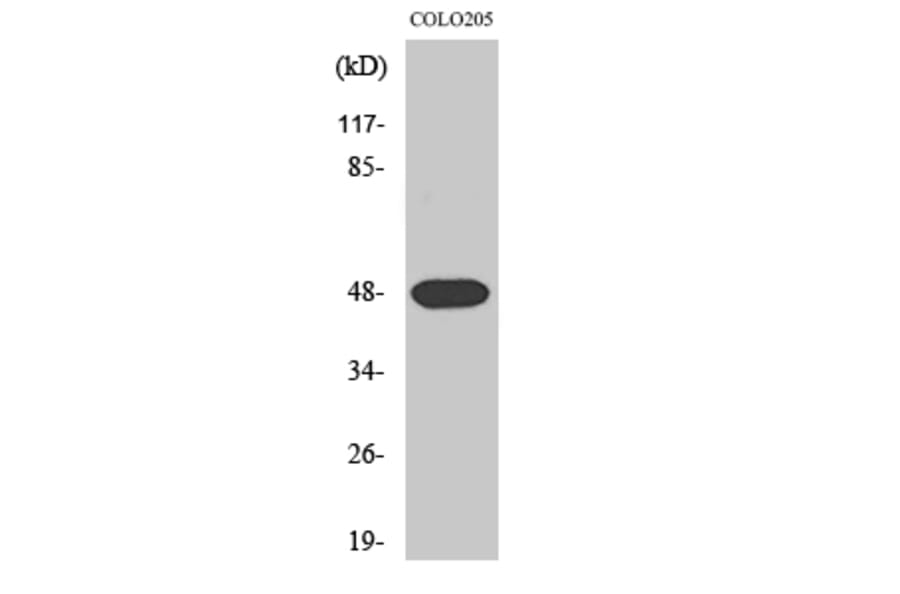 Western Blot - Anti-SYT11 Antibody (C19011) - Antibodies.com