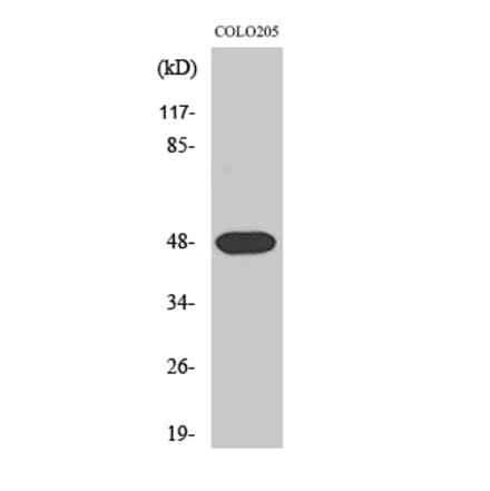 Western Blot - Anti-SYT11 Antibody (C19011) - Antibodies.com