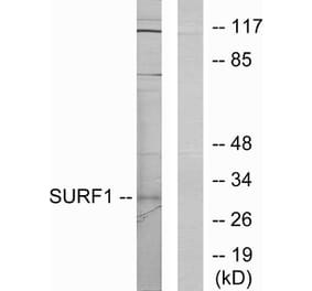 Western Blot - Anti-SURF1 Antibody (C11080) - Antibodies.com