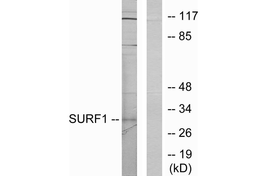 Western Blot - Anti-SURF1 Antibody (C11080) - Antibodies.com
