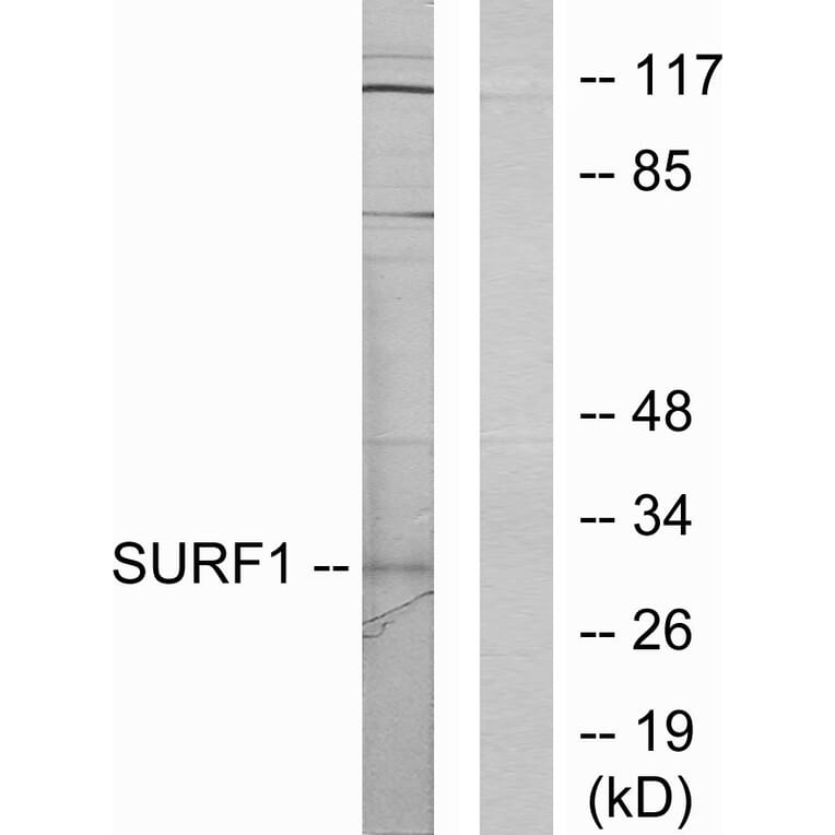 Western Blot - Anti-SURF1 Antibody (C11080) - Antibodies.com