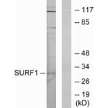 Western Blot - Anti-SURF1 Antibody (C11080) - Antibodies.com