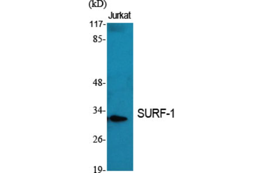 Western Blot - Anti-SURF1 Antibody (C11080) - Antibodies.com