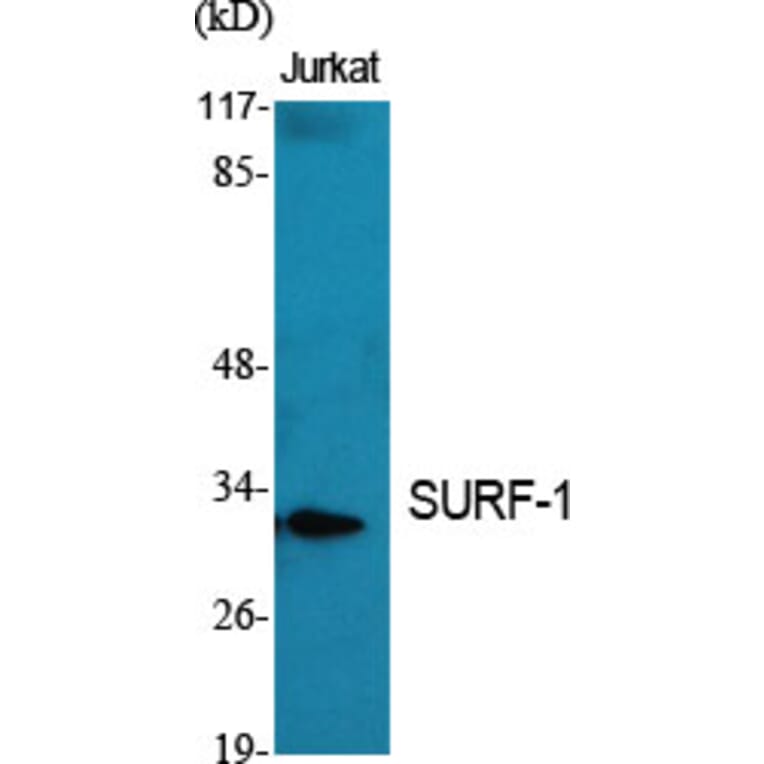 Western Blot - Anti-SURF1 Antibody (C11080) - Antibodies.com