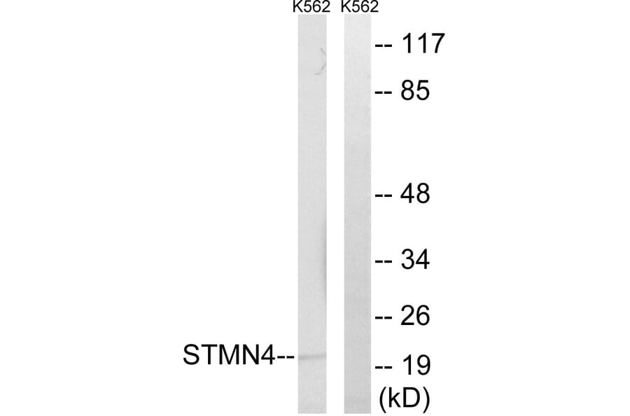 Western Blot - Anti-STMN4 Antibody (C18953) - Antibodies.com