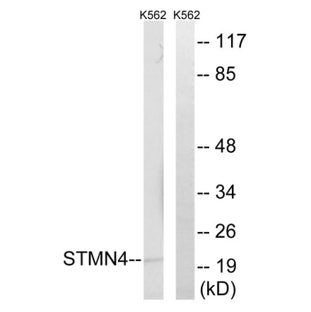 Western Blot - Anti-STMN4 Antibody (C18953) - Antibodies.com
