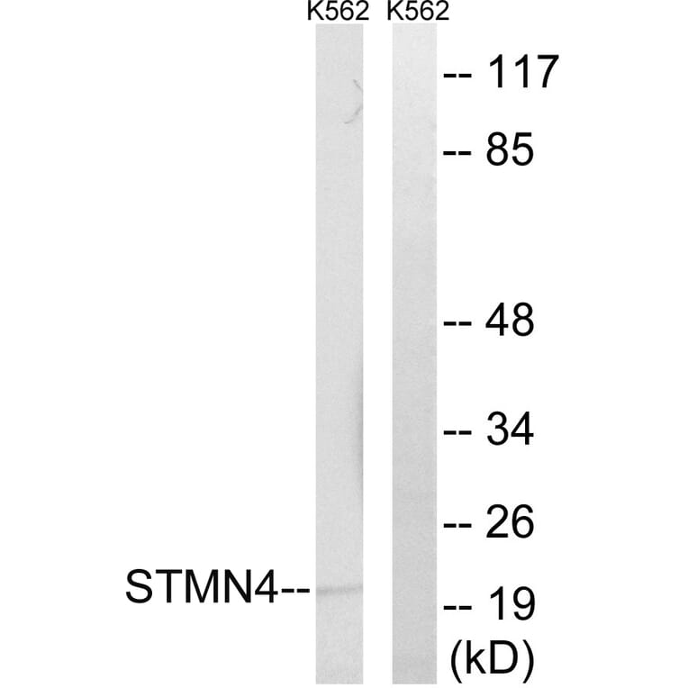 Western Blot - Anti-STMN4 Antibody (C18953) - Antibodies.com