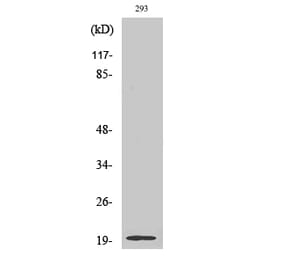 Western Blot - Anti-STMN3 Antibody (C18952) - Antibodies.com