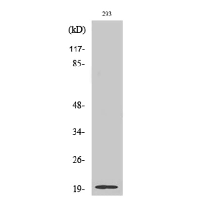 Western Blot - Anti-STMN3 Antibody (C18952) - Antibodies.com