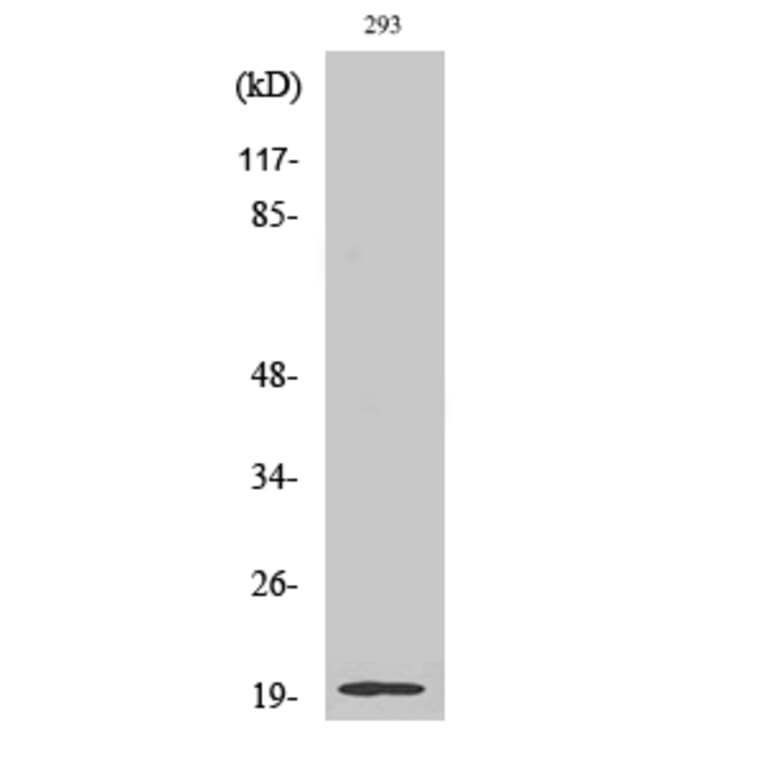 Western Blot - Anti-STMN3 Antibody (C18952) - Antibodies.com