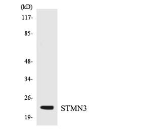 Western Blot - Anti-STMN3 Antibody (R12-3574) - Antibodies.com
