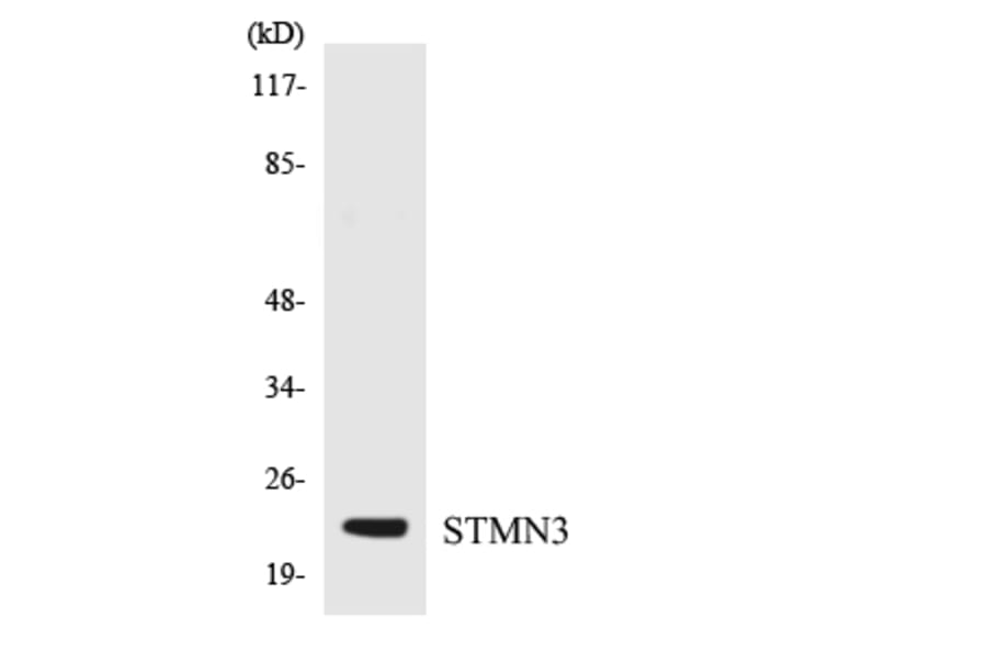 Western Blot - Anti-STMN3 Antibody (R12-3574) - Antibodies.com