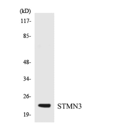 Western Blot - Anti-STMN3 Antibody (R12-3574) - Antibodies.com