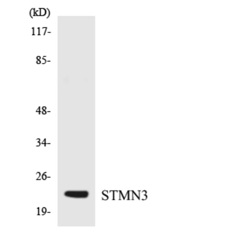 Western Blot - Anti-STMN3 Antibody (R12-3574) - Antibodies.com