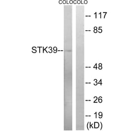 Western Blot - Anti-STK39 Antibody (B8187) - Antibodies.com
